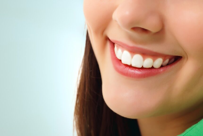 What are porcelain veneers?